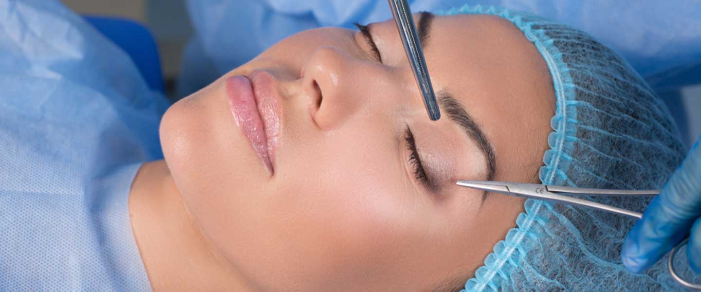 Que é a estética das pálpebras (blefaroplastia)?