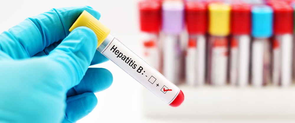 Que é a hepatite B? Cales son os síntomas e métodos de tratamento?